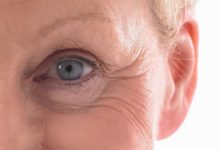 Photo of Things you Need to Know About Eye Bag Surgery