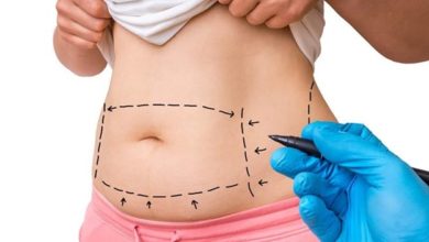 Photo of Tummy Tuck in Los Angeles: Plastic Surgery Procedures