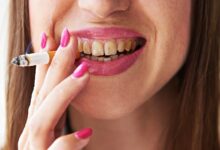Photo of Smokeless Tobacco’s Effects On Oral Health