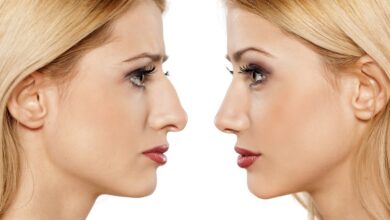 Photo of What Is Nose Augmentation, And What Are Its Advantages