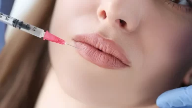 Photo of What is the recovery time for lip filler treatments and what aftercare instructions should I follow?